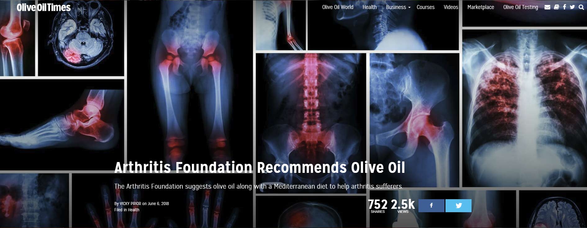 Nadácia pre artritídu odporúča olivový olej